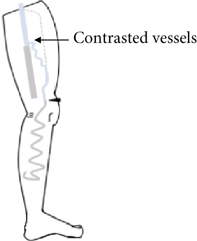 Details are in the caption following the image