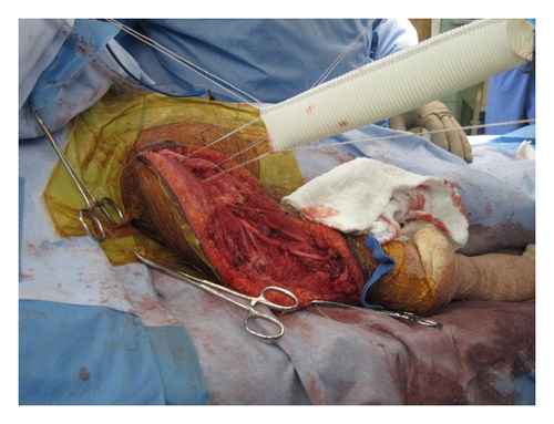 Details are in the caption following the image Details are in the caption following the image