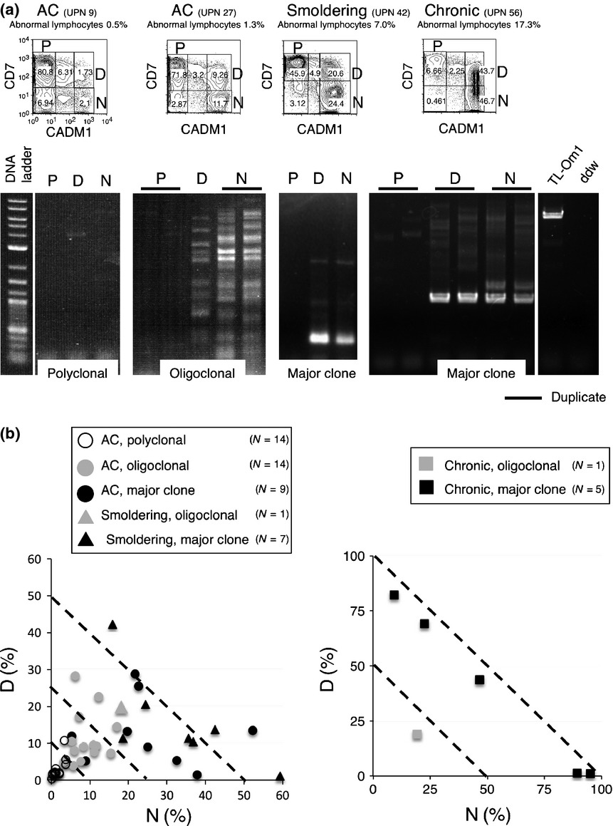 Advanced human T-cell leukemia virus type 1 carriers and early-stage indolent adult T-cell leukemia-lymphoma are indistinguishable based on CADM1 positivity in flow cytometry