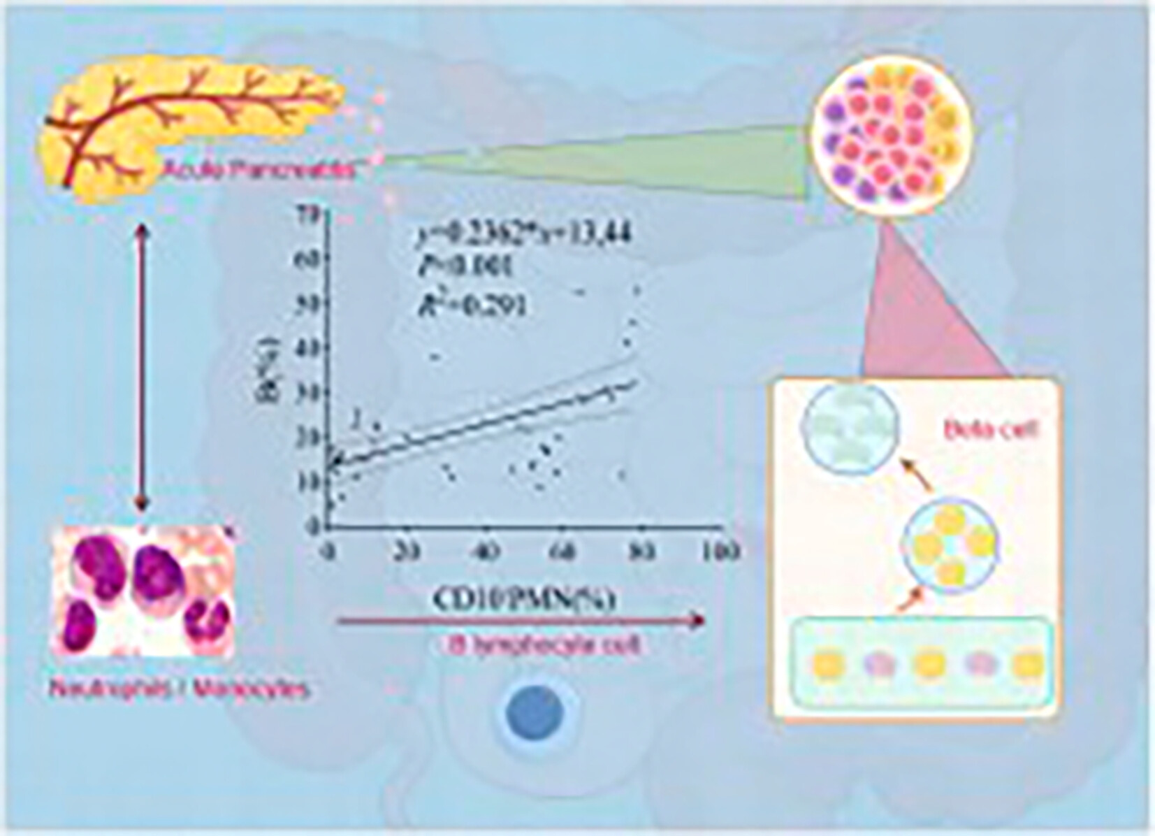 B Lymphocyte—A Prognostic Indicator in Post-Acute Pancreatitis Diabetes Mellitus