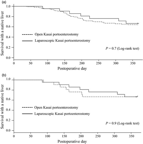 Multicenter, retrospective, comparative study of laparoscopic and open Kasai portoenterostomy in children with biliary atresia from Japanese high-volume centers