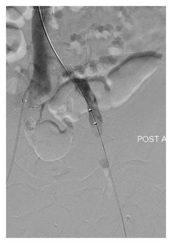 Details are in the caption following the image