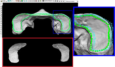 An osteometric and 3D analysis of the atlanto-occipital joint: An initial screening method to exclude crania and atlases in commingled remains
