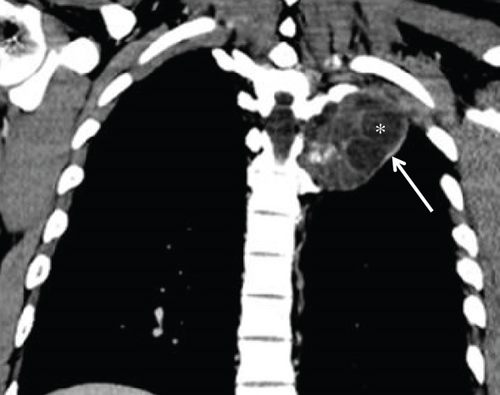 Details are in the caption following the image