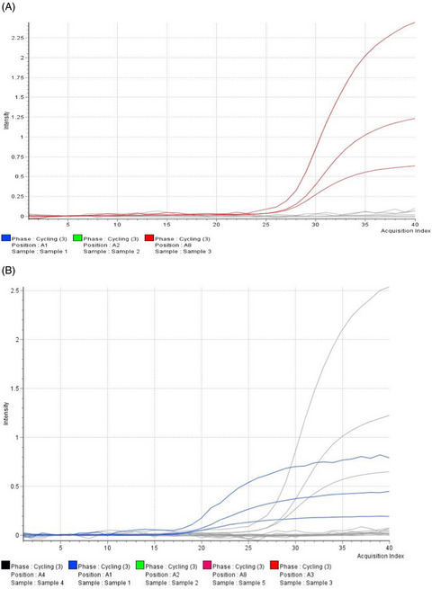 Comparison of Real-Q 2019-nCoV and DaAn Gene 2019-nCoV polymerase chain reaction assays for the detection of SARS-CoV-2