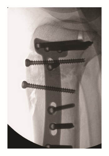 Details are in the caption following the image