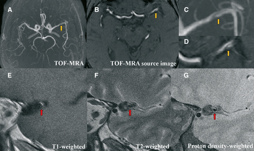 Details are in the caption following the image