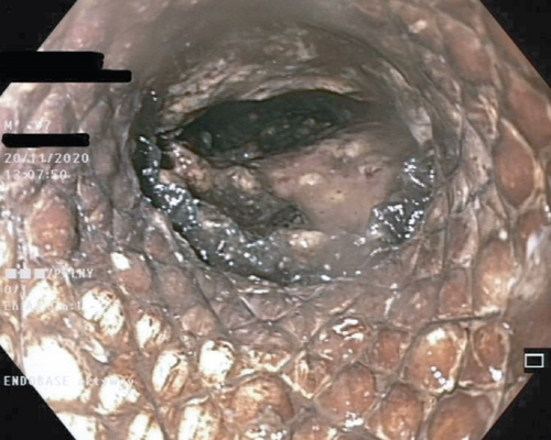 Details are in the caption following the image Details are in the caption following the image