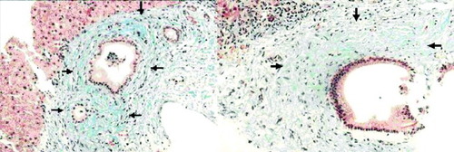 Details are in the caption following the image
