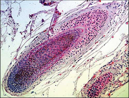 Details are in the caption following the image