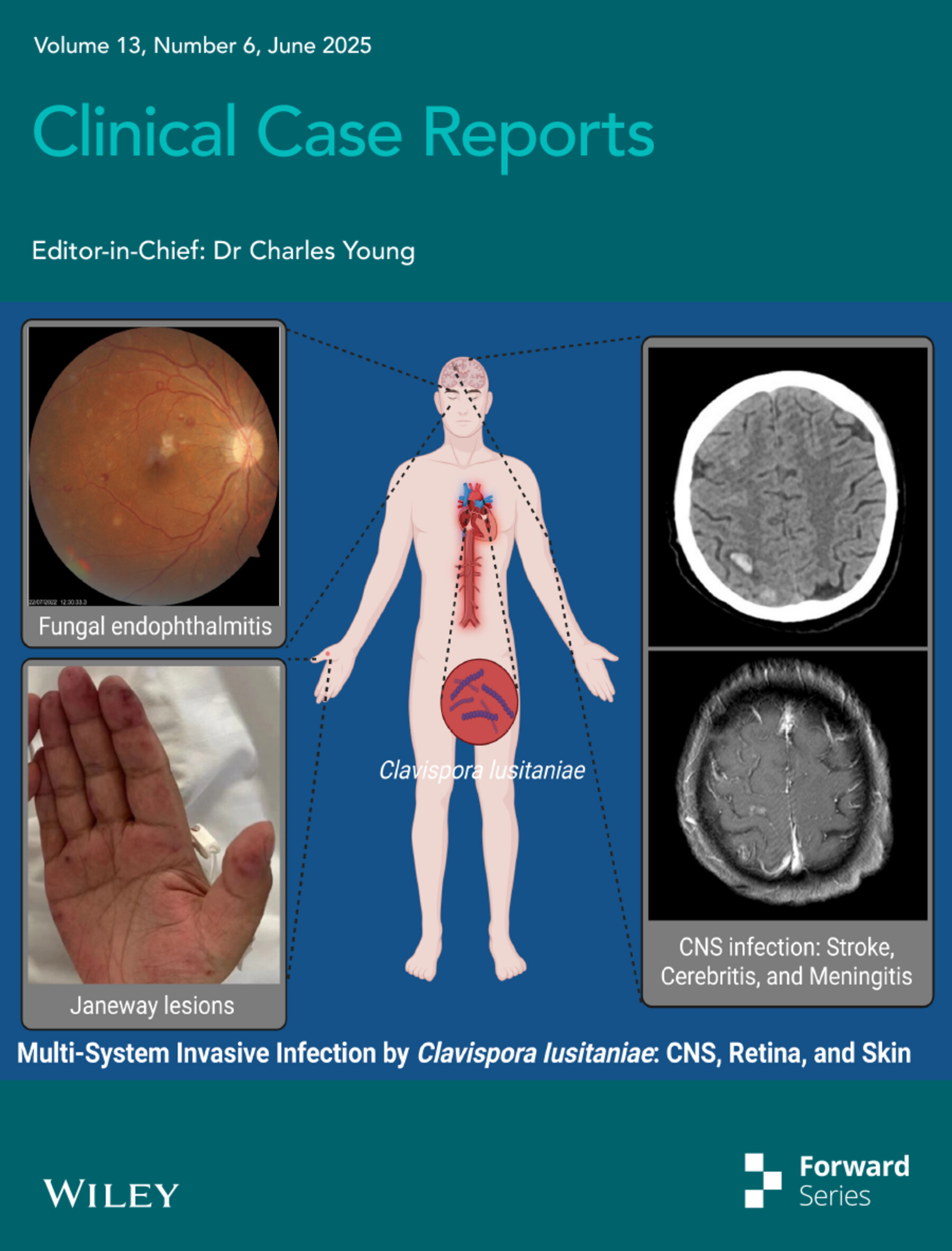 Cover Image Volume 13 Issue 6, 2025
