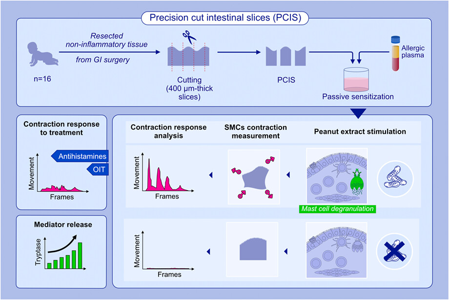 Precision cut intestinal slices, a novel model of acute food allergic reactions
