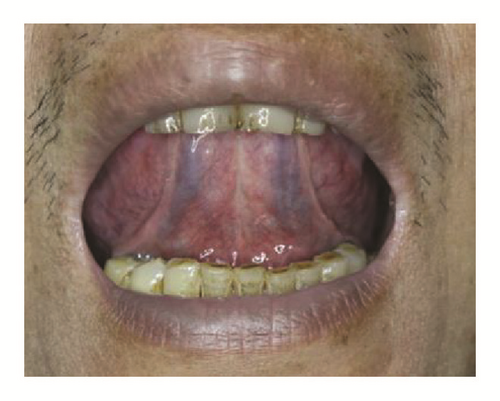 Details are in the caption following the image Details are in the caption following the image