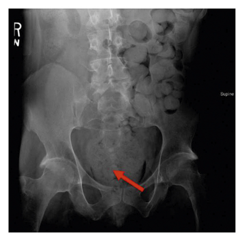 Details are in the caption following the image Details are in the caption following the image