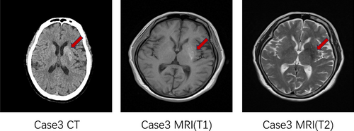 Details are in the caption following the image