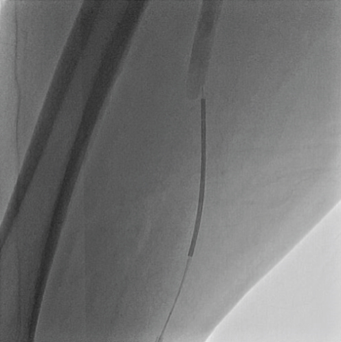 Details are in the caption following the image
