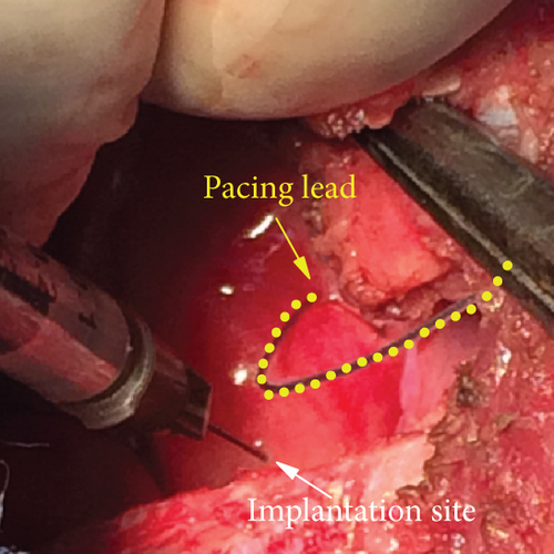 Details are in the caption following the image Details are in the caption following the image