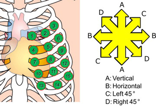 Details are in the caption following the image