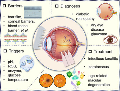 Responsive Microneedles for Diagnostic and Therapeutic Applications of Ocular Diseases