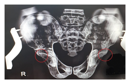 Details are in the caption following the image