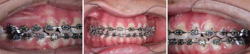 Details are in the caption following the image Details are in the caption following the image