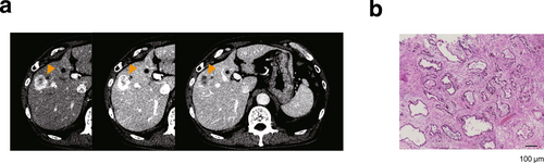 Details are in the caption following the image