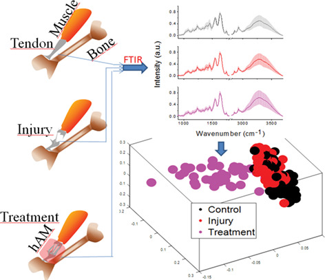 Tendinopathy diagnosis and treatment monitoring using attenuated total reflectance-Fourier transform infrared spectroscopy