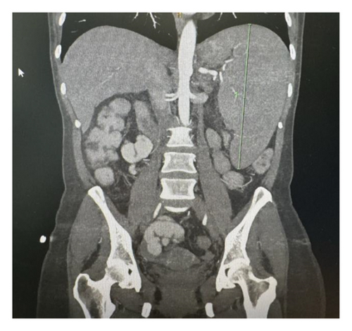Details are in the caption following the image