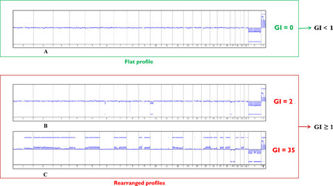 Genomic complexity in pediatric synovial sarcomas (Synobio study): the European pediatric soft tissue sarcoma group (EpSSG) experience