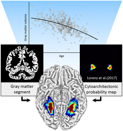 The impact of aging on the subregions of the fusiform gyrus in healthy older adults