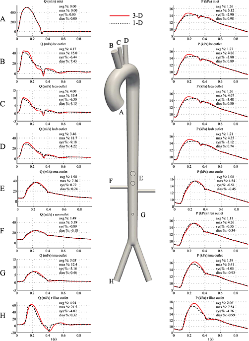 A systematic comparison between 1-D and 3-D hemodynamics in compliant arterial models Issue 2, 2014