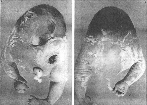 Details are in the caption following the image
