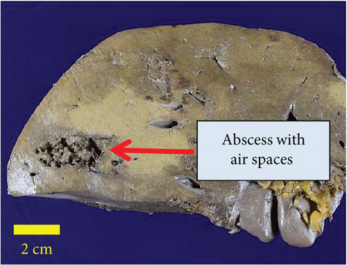 Details are in the caption following the image