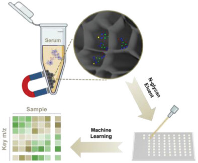 Branched Hierarchical Porous Carbon Enables Ultrasensitive Detection of Serum Glycans for Comprehensive Assessment of Urological Cancers