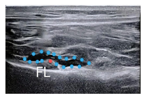 Details are in the caption following the image Details are in the caption following the image