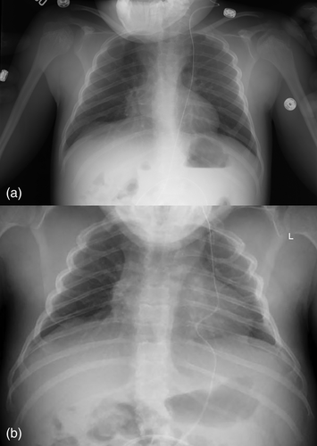 Details are in the caption following the image