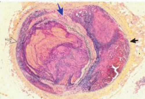 Details are in the caption following the image