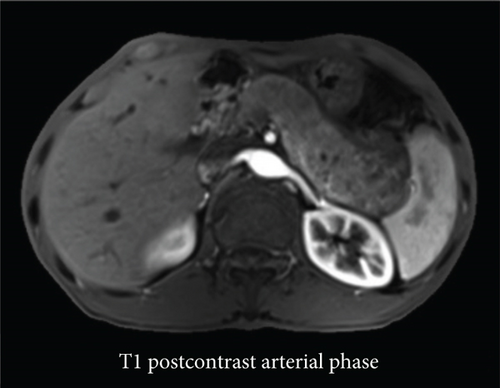 Details are in the caption following the image
