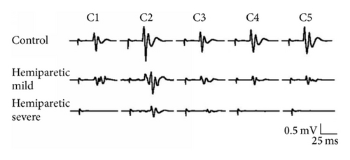 Details are in the caption following the image
