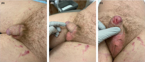 Details are in the caption following the image Details are in the caption following the image