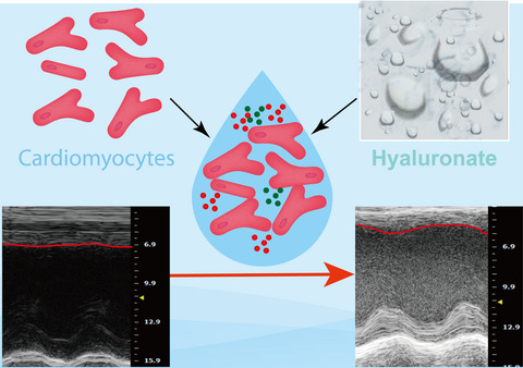 Hyaluronate supports hESC-cardiomyocyte cell therapy for cardiac regeneration after acute myocardial infarction
