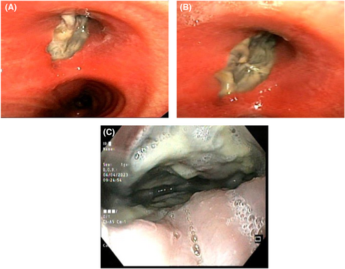 Details are in the caption following the image Details are in the caption following the image