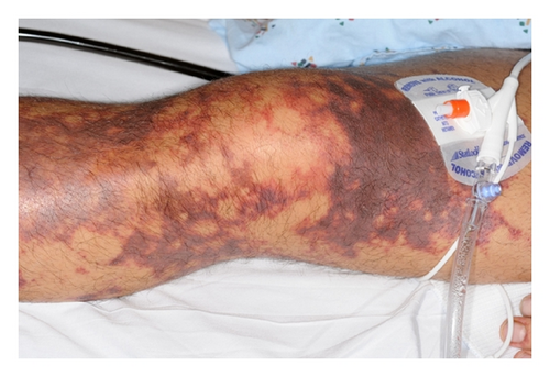 Details are in the caption following the image Details are in the caption following the image