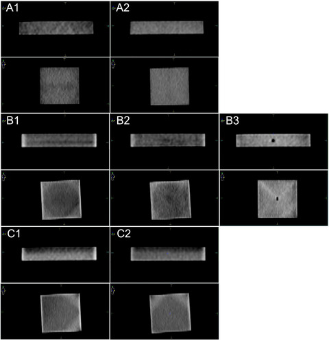 Not all 3D-printed bolus is created equal: Variation between 3D-printed polylactic acid (PLA) bolus samples sourced from external manufacturers