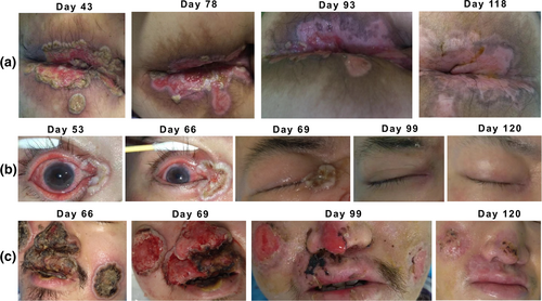 Details are in the caption following the image Details are in the caption following the image