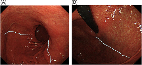 Details are in the caption following the image Details are in the caption following the image