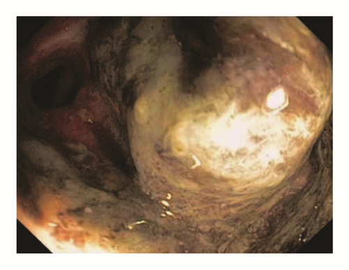 Details are in the caption following the image Details are in the caption following the image