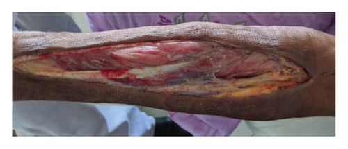 Details are in the caption following the image Details are in the caption following the image