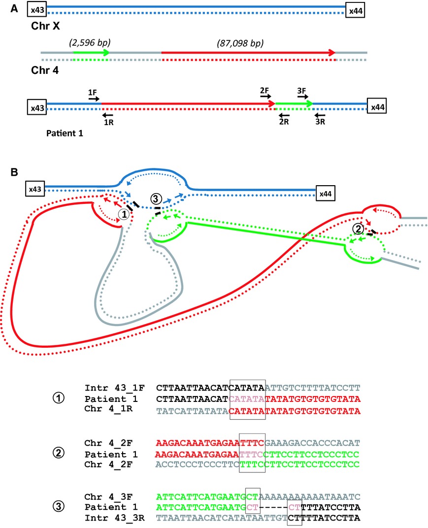Complex genomic rearrangements in the dystrophin gene due to replication-based mechanisms