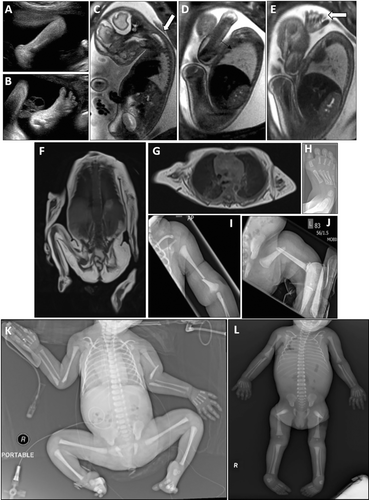 Details are in the caption following the image Details are in the caption following the image